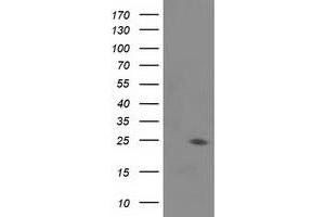 Image no. 1 for anti-Josephin Domain Containing 1 (JOSD1) antibody (ABIN2723941)
