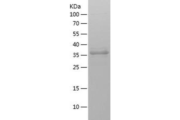 PIK3CB Protein (AA 131-257) (IF2DI tag)