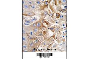 Image no. 2 for anti-Cytochrome P450, Family 2, Subfamily W, Polypeptide 1 (CYP2W1) (AA 7-33), (N-Term) antibody (ABIN392221)