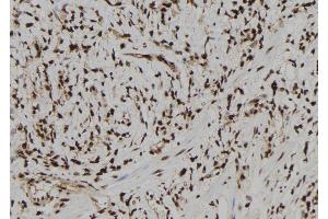 ABIN6273180 at 1/100 staining Human gastric tissue by IHC-P.