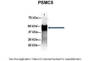 Image no. 2 for anti-Proteasome (Prosome, Macropain) 26S Subunit, ATPase, 5 (PSMC5) (C-Term) antibody (ABIN2780449)