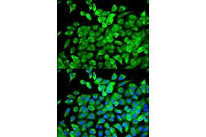 Image no. 1 for anti-Eukaryotic Translation Initiation Factor 4A1 (EIF4A1) antibody (ABIN6140076)