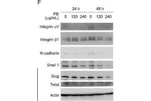 Image no. 3 for anti-SNAIL (SNAI1) (Center) antibody (ABIN2854294)