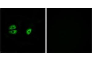 Image no. 2 for anti-Mitochondrial Ribosomal Protein S22 (MRPS22) (AA 231-280) antibody (ABIN1535022)