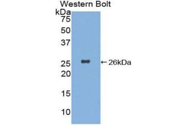 anti-Xeroderma Pigmentosum, Complementation Group C (XPC) (AA 734-933) antibody