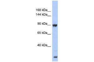 Image no. 1 for anti-Upregulator of Cell Proliferation (URGCP) (Middle Region) antibody (ABIN630797)
