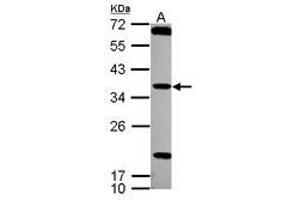 Image no. 1 for anti-Testis Specific Serine Kinase 4 (TSSK4) (AA 100-328) antibody (ABIN1501544)