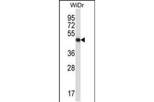 Image no. 1 for anti-Ubiquinol-Cytochrome C Reductase Core Protein II (UQCRC2) (AA 235-264) antibody (ABIN5534776)