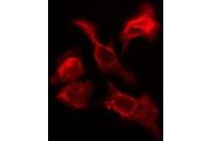Image no. 2 for anti-Mevalonate Kinase (MVK) antibody (ABIN6263444)