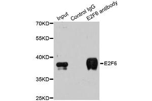 Image no. 3 for anti-E2F Transcription Factor 6 (E2F6) antibody (ABIN6570272)