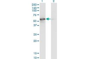 Image no. 3 for anti-serine/threonine Kinase 25 (STK25) (AA 321-426) antibody (ABIN523909)