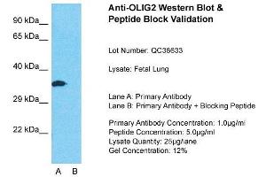 Image no. 3 for anti-Oligodendrocyte Lineage Transcription Factor 2 (OLIG2) (C-Term) antibody (ABIN2777566)