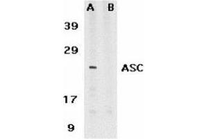 Image no. 2 for anti-PYD and CARD Domain Containing (PYCARD) antibody (ABIN499343)