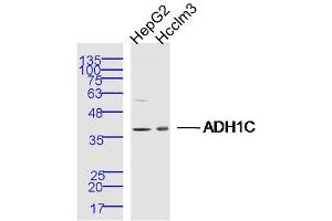 Image no. 1 for anti-Alcohol Dehydrogenase 1C (Class I), gamma Polypeptide (ADH1C) (AA 281-375) antibody (ABIN5675478)