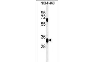 KCTD1 Antikörper  (C-Term)