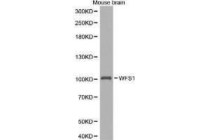 Western Blotting (WB) image for anti-Wolfram Syndrome 1 (WFS1) (AA 1-285) antibody (ABIN1513689)