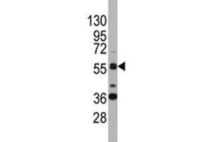 anti-SRY (Sex Determining Region Y)-Box 9 (SOX9) (AA 41-70) antibody