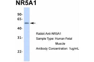 Image no. 1 for anti-Nuclear Receptor Subfamily 5, Group A, Member 1 (NR5A1) (Middle Region) antibody (ABIN2777447)