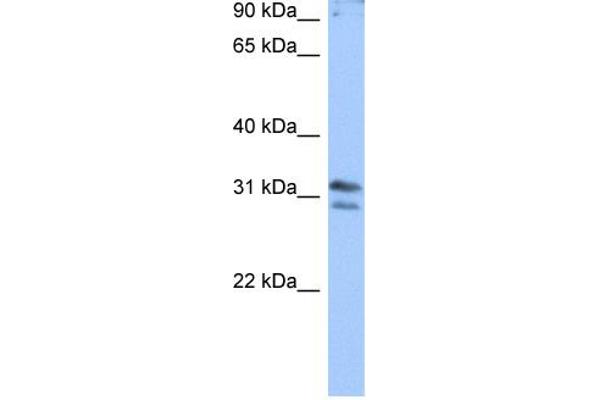 anti-RNA (Guanine-9-) Methyltransferase Domain Containing 3 (RG9MTD3) (N-Term) antibody