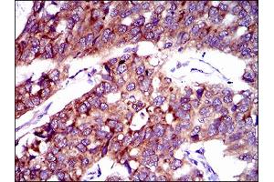 SLC27A2 antibody  (AA 346-405)