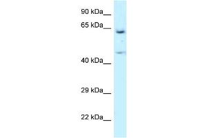 Image no. 1 for anti-Asparaginyl-tRNA Synthetase (NARS) (N-Term) antibody (ABIN2788821)
