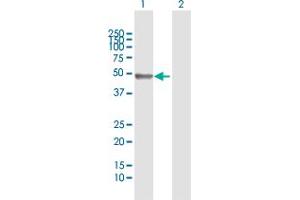 Image no. 2 for anti-Immunoglobulin Heavy Constant gamma 1 (G1m Marker) (IGHG1) (AA 1-469) antibody (ABIN1327259)