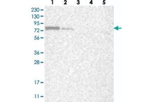Image no. 1 for anti-La Ribonucleoprotein Domain Family, Member 7 (LARP7) antibody (ABIN5582388)