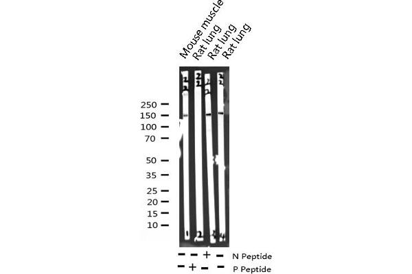 Phospholipase C gamma 2 anticorps  (pTyr753)