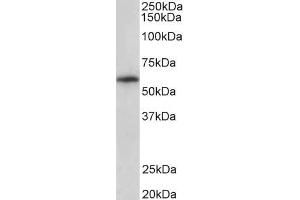 Image no. 2 for anti-TXK tyrosine Kinase (TXK) (C-Term) antibody (ABIN570663)