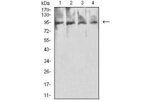 Image no. 2 for anti-Folate Hydrolase (Prostate-Specific Membrane Antigen) 1 (FOLH1) (AA 44-177) antibody (ABIN5611345)