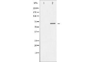Image no. 4 for anti-Dystrophin Related Protein 2 (DRP2) (pThr514) antibody (ABIN6255705)