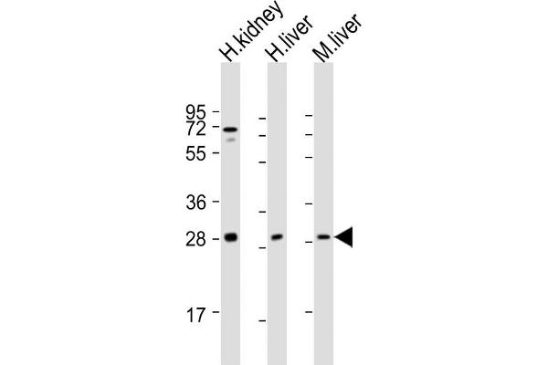 SIRT3 Antikörper  (C-Term)