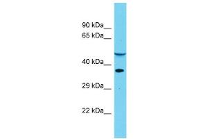 Image no. 1 for anti-Dihydrouridine Synthase 4-Like (DUS4L) (Middle Region) antibody (ABIN2791004)