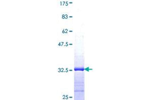 PALLD Protein (AA 775-839) (GST tag)