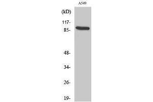 Image no. 1 for anti-Cadherin-16 (CDH16) (C-Term) antibody (ABIN3183612)