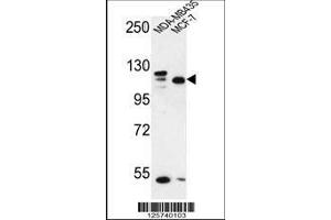Image no. 1 for anti-SEC24 Family, Member C (SEC24C) (AA 443-470) antibody (ABIN650969)