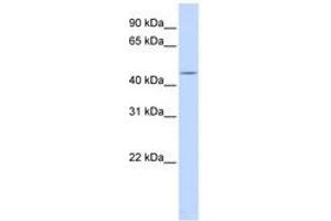 Image no. 1 for anti-Heat Shock Transcription Factor, Y-Linked 1 (HSFY1) (C-Term) antibody (ABIN6740624)