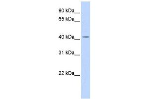 Image no. 1 for anti-Dehydrodolichyl Diphosphate Synthase (DHDDS) (N-Term) antibody (ABIN631604)
