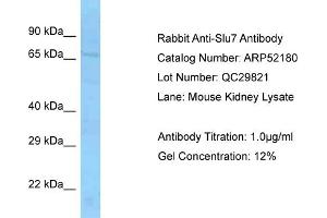 Image no. 1 for anti-SLU7 Splicing Factor Homolog (SLU7) (Middle Region) antibody (ABIN2774006)