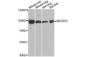 Image no. 4 for anti-Melanoma Antigen Family D, 1 (MAGED1) antibody (ABIN3021415)