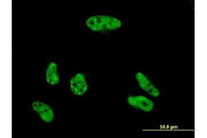 Image no. 2 for anti-Vacuolar Protein Sorting 72 Homolog (S. Cerevisiae) (VPS72) (AA 1-364) antibody (ABIN563124)