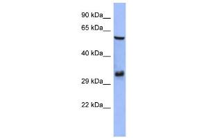 Image no. 2 for anti-FOS-Like Antigen 1 (FOSL1) (Middle Region) antibody (ABIN2777266)