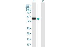Western Blot analysis of CRELD1 expression in transfected 293T cell line by CRELD1 MaxPab polyclonal antibody.
