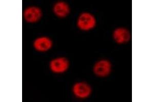 Image no. 2 for anti-MRE11 Meiotic Recombination 11 Homolog A (S. Cerevisiae) (MRE11A) (C-Term) antibody (ABIN6263351)