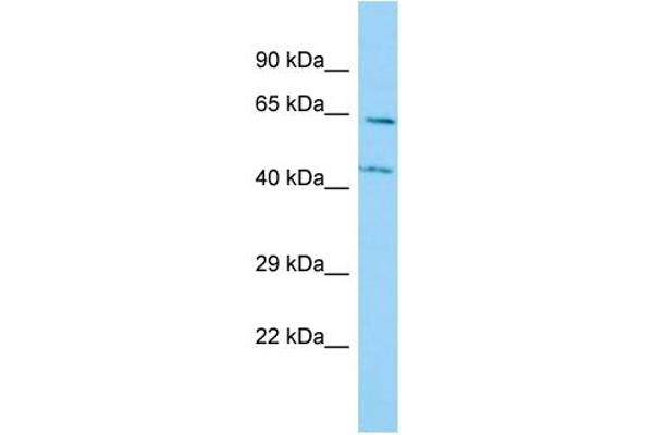 anti-Prolyl 4-Hydroxylase, alpha Polypeptide III (P4HA3) (N-Term) antibody