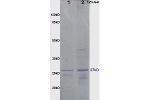 Image no. 4 for anti-Heat Shock 27kDa Protein 1 (HSPB1) (AA 101-205) antibody (ABIN672441)