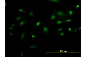 Image no. 1 for anti-NIMA (Never in Mitosis Gene A)-Related Kinase 2 (NEK2) (AA 331-445) antibody (ABIN561956)