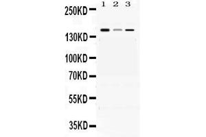 Image no. 1 for anti-ADAM Metallopeptidase with Thrombospondin Type 1 Motif, 13 (ADAMTS13) (AA 299-488) antibody (ABIN4886425)