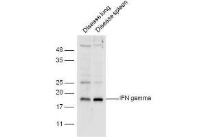 Interferon gamma Antikörper  (AA 75-155)