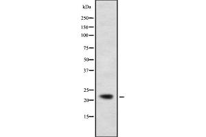 Image no. 3 for anti-Cytidine Monophosphate (UMP-CMP) Kinase 1, Cytosolic (CMPK1) (N-Term) antibody (ABIN6265893)